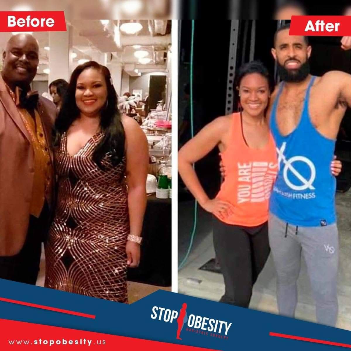 Happy, slim teenager after bariatric surgery